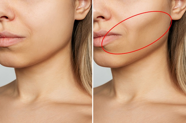 Khuôn mặt lệch, nếp nhăn sớm có thể bắt nguồn từ việc mất răng – Đừng xem nhẹ! - Ảnh 1. Khuôn mặt lệch, nếp nhăn sớm có thể bắt nguồn từ việc mất răng – Đừng xem nhẹ! - Ảnh 1.