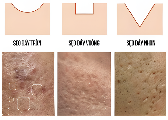 Em Mây Skin Center - Phòng khám tiên phong điều trị sẹo đa phương pháp - Ảnh 2. Em Mây Skin Center - Phòng khám tiên phong điều trị sẹo đa phương pháp - Ảnh 2.