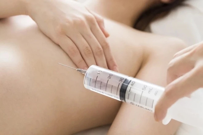 Khám cho bệnh nhân có nhiều u tuyến giáp, bác sĩ kinh hãi vì phát hiện cô đã tiêm 1 thứ vào ngực, mông: "QUÁ NGUY HIỂM"! - Ảnh 3. Khám cho bệnh nhân có nhiều u tuyến giáp, bác sĩ kinh hãi vì phát hiện cô đã tiêm 1 thứ vào ngực, mông: "QUÁ NGUY HIỂM"! - Ảnh 3.