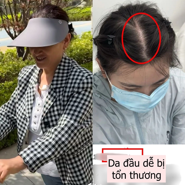 Lời khuyên cho phụ nữ trung niên: 3 kiểu mũ "dù có cho cũng đừng đội" vì vừa rẻ tiền vừa không chống nắng! - Ảnh 4. Lời khuyên cho phụ nữ trung niên: 3 kiểu mũ "dù có cho cũng đừng đội" vì vừa rẻ tiền vừa không chống nắng! - Ảnh 4.