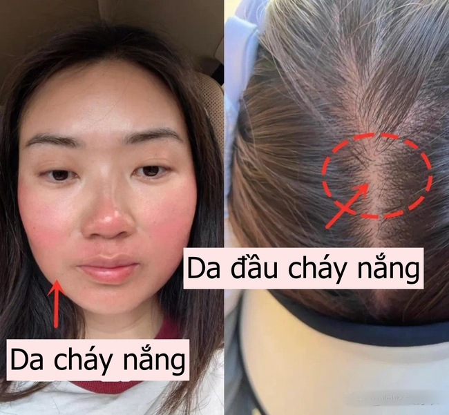 Lời khuyên cho phụ nữ trung niên: 3 kiểu mũ "dù có cho cũng đừng đội" vì vừa rẻ tiền vừa không chống nắng! - Ảnh 8. Lời khuyên cho phụ nữ trung niên: 3 kiểu mũ "dù có cho cũng đừng đội" vì vừa rẻ tiền vừa không chống nắng! - Ảnh 8.