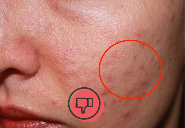 Thoát khỏi nỗi khổ của da nhờn dính bằng 5 bước skincare kiềm dầu, chị em yên tâm với làn da láng mịn - Ảnh 1. Thoát khỏi nỗi khổ của da nhờn dính bằng 5 bước skincare kiềm dầu, chị em yên tâm với làn da láng mịn - Ảnh 1.