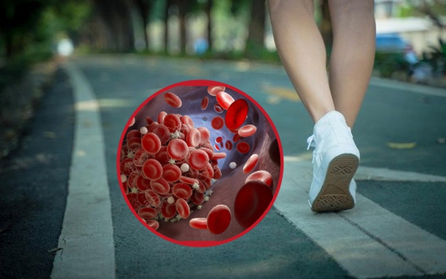 Trước khi một căn bệnh nghiêm trọng ập đến, bạn có thể nhận ra thay đổi khi đi bộ: Nếu có 4 triệu chứng này thì hãy đi khám ngay - Ảnh 2. Trước khi một căn bệnh nghiêm trọng ập đến, bạn có thể nhận ra thay đổi khi đi bộ: Nếu có 4 triệu chứng này thì hãy đi khám ngay - Ảnh 2.