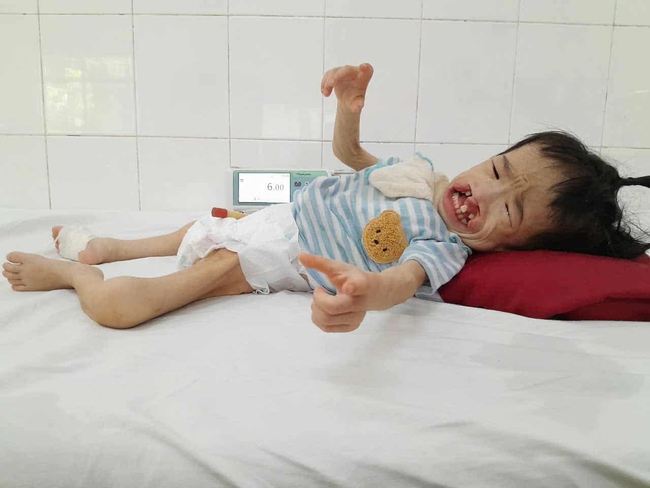 Bé gái 3 tuổi có khuôn mặt biến dạng vì dị tật mong chờ cơ hội được phẫu thuật - Ảnh 1. Bé gái 3 tuổi có khuôn mặt biến dạng vì dị tật mong chờ cơ hội được phẫu thuật - Ảnh 1.