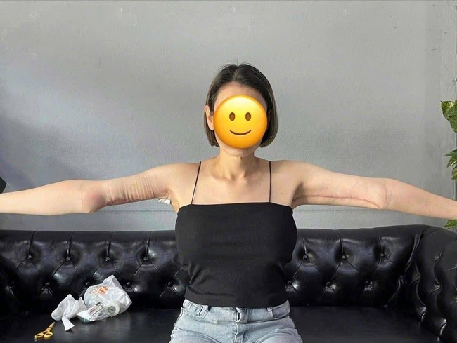 MXH rúng động vụ cánh tay biến dạng sau hút mỡ, cắt da thừa giá 10 triệu đồng: BS nói đi làm đẹp cần ghi nhớ điều này tránh tiền mất tật mang - Ảnh 2. MXH rúng động vụ cánh tay biến dạng sau hút mỡ, cắt da thừa giá 10 triệu đồng: BS nói đi làm đẹp cần ghi nhớ điều này tránh tiền mất tật mang - Ảnh 2.