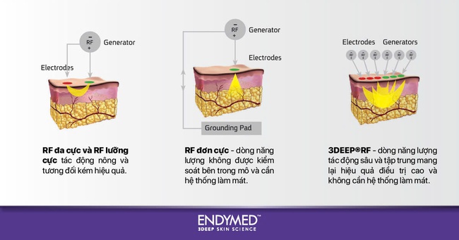 EndyMed Pro - Bệ phóng tái tạo & trẻ hóa làn da thế hệ mới tại DR. REJU Beauty Medi - Ảnh 2. EndyMed Pro - Bệ phóng tái tạo & trẻ hóa làn da thế hệ mới tại DR. REJU Beauty Medi - Ảnh 2.