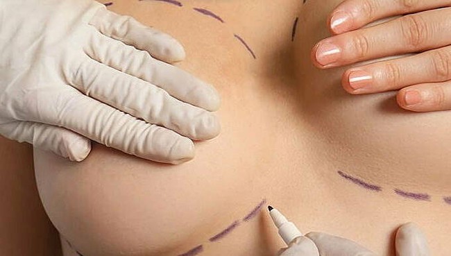 Jun Vũ khoe lưng trần gây sốt nhưng quay lại càng khiến dân tình phải "wow": Nâng ngực giúp thăng hạng visual, nhiều mỹ nhân sau sinh cũng làm và chưa từng hối hận - Ảnh 5. Jun Vũ khoe lưng trần gây sốt nhưng quay lại càng khiến dân tình phải "wow": Nâng ngực giúp thăng hạng visual, nhiều mỹ nhân sau sinh cũng làm và chưa từng hối hận - Ảnh 5.