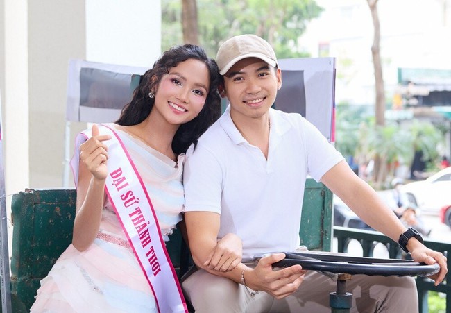 Chồng H'Hen Niê thay đổi thế nào sau cấy tóc trị hói đầu? Phương pháp này có giá bao nhiêu? - Ảnh 4. Chồng H'Hen Niê thay đổi thế nào sau cấy tóc trị hói đầu? Phương pháp này có giá bao nhiêu? - Ảnh 4.