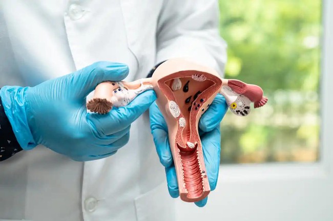 Cảm giác của 1 người phụ nữ bị cắt tử cung sẽ như thế nào? Đã cắt bỏ tử cung 3 năm và tôi muốn chia sẻ trải nghiệm của mình với bạn... - Ảnh 1.