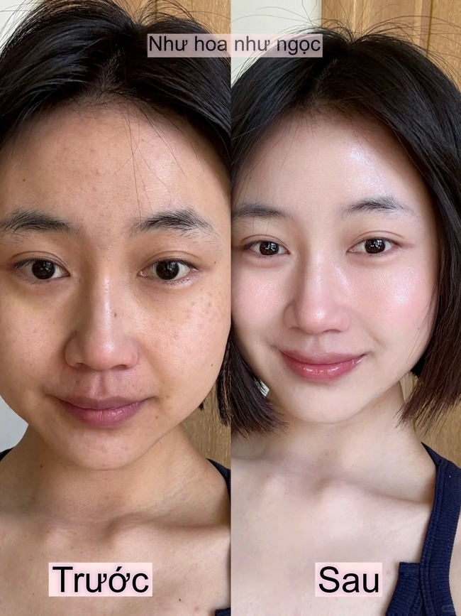 Tôi bổ sung collagen suốt 1 năm và đây là điều đã thay đổi trên gương mặt tôi  - Ảnh 3.