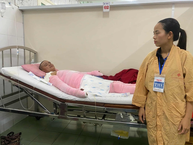 Xót xa hoàn cảnh người đàn ông bỏng nặng khi đi làm thuê kiếm tiền chạy chữa cho vợ - Ảnh 1.