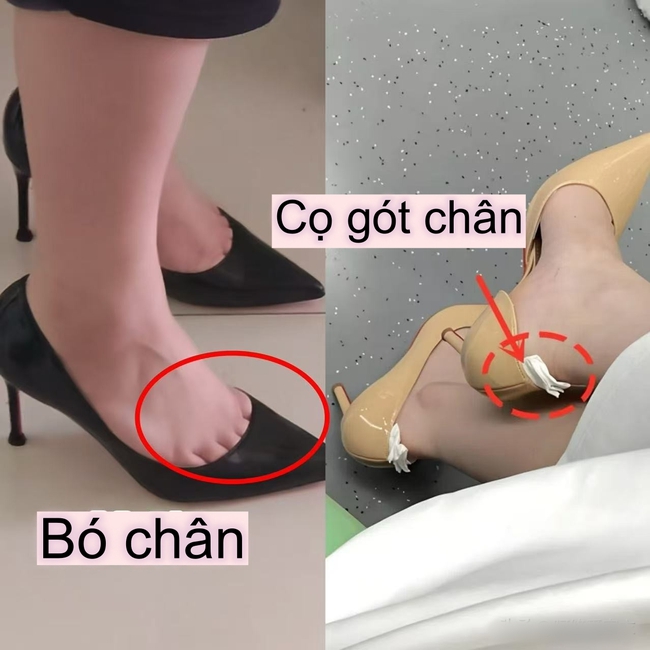 Phụ nữ dù ở độ tuổi nào, mua giày cũng nên tránh xa 4 kiểu này: Vừa quê mùa vừa kém sang - Ảnh 5. Phụ nữ dù ở độ tuổi nào, mua giày cũng nên tránh xa 4 kiểu này: Vừa quê mùa vừa kém sang - Ảnh 5.