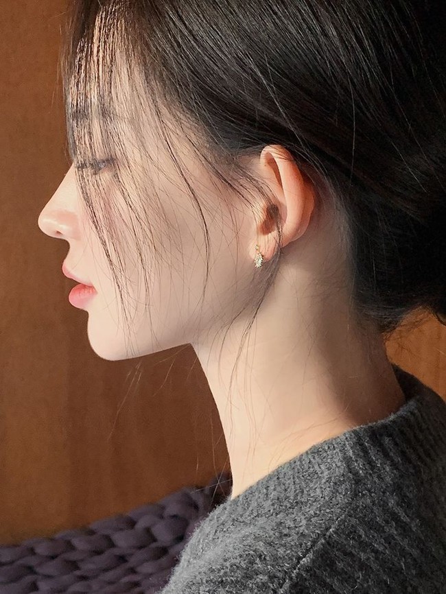 Những dấu hiệu bạn đang bị biến chứng sau khi làm mũi - Ảnh 3. Những dấu hiệu bạn đang bị biến chứng sau khi làm mũi - Ảnh 3.