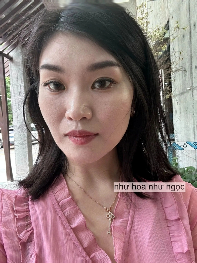Tôi đã trẻ hóa da thành công nhờ collagen, mất đúng 2 năm để thay đổi làn da sẹo rỗ - Ảnh 5. Tôi đã trẻ hóa da thành công nhờ collagen, mất đúng 2 năm để thay đổi làn da sẹo rỗ - Ảnh 5.