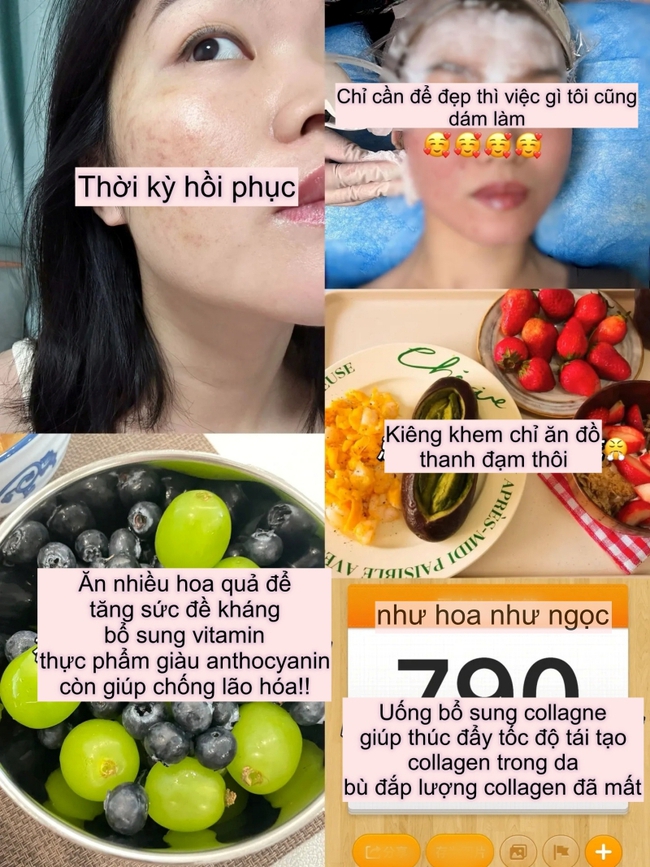 Tôi đã trẻ hóa da thành công nhờ collagen, mất đúng 2 năm để thay đổi làn da sẹo rỗ - Ảnh 4. Tôi đã trẻ hóa da thành công nhờ collagen, mất đúng 2 năm để thay đổi làn da sẹo rỗ - Ảnh 4.