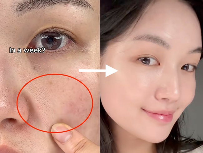 serum retinol - Ảnh 3. serum retinol - Ảnh 3.