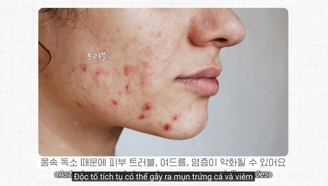 Nước uống detox &quot;chống già&quot; của phái đẹp Hàn: Uống 3 lần/tuần, vừa mịn da vừa gọn bụng, giúp đẹp từ da đến dáng - Ảnh 4.