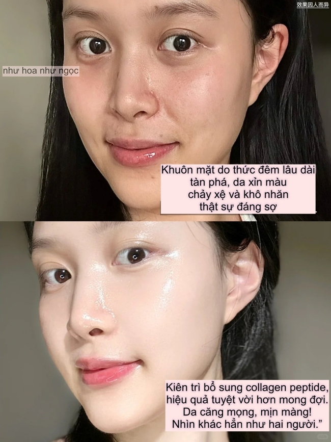 Tôi gần 30 tuổi nhưng vẫn bị nhầm là thực tập sinh: Bí quyết của tôi chính là collagen peptide - Ảnh 1. Tôi gần 30 tuổi nhưng vẫn bị nhầm là thực tập sinh: Bí quyết của tôi chính là collagen peptide - Ảnh 1.
