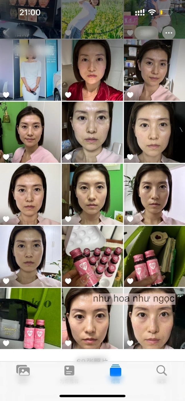Chụp ảnh mặt mộc hàng ngày trong 1 tháng khi uống collagen, có 1 điểm trên mặt thay đổi mà tôi nhận thấy rõ  - Ảnh 6.
