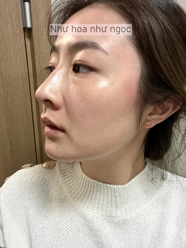 Tôi đã bù đắp lại lượng collagen đã mất bằng cách làm điều này mỗi tối trước khi ngủ - Ảnh 4.