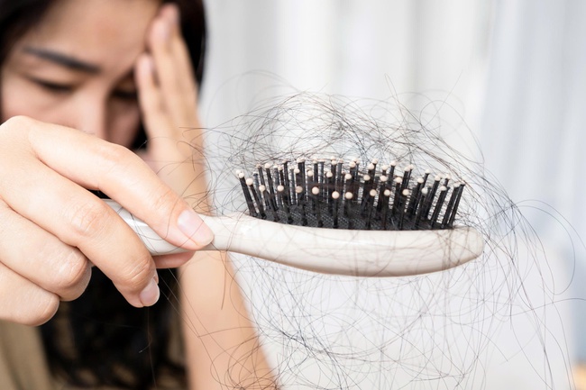 Chấm dứt nỗi lo rụng tóc sau sinh với TPBVSK Codeage Hair Vitamins - Ảnh 2.