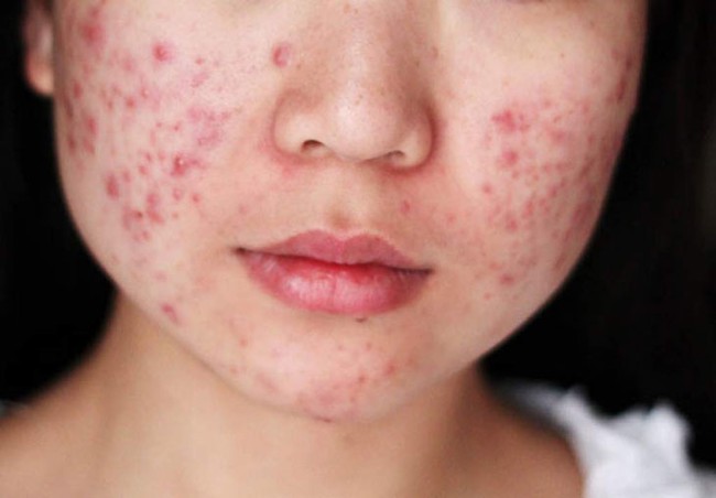 Tôi đã học Hòa Minzy uống 1 loại nước dân dã mong ngăn rối loạn nội tiết sau sinh, 1 tháng sau nhận ngay câu trả lời - Ảnh 1. Tôi đã học Hòa Minzy uống 1 loại nước dân dã mong ngăn rối loạn nội tiết sau sinh, 1 tháng sau nhận ngay câu trả lời - Ảnh 1.