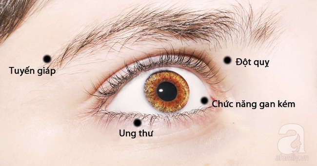 Nhận biết tình trạng sức khỏe qua những dấu hiệu của mắt - Ảnh 1.