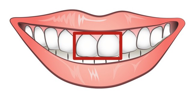 Không đùa đâu, răng cửa cũng có thể tiết lộ tính cách của bạn - Ảnh 1.