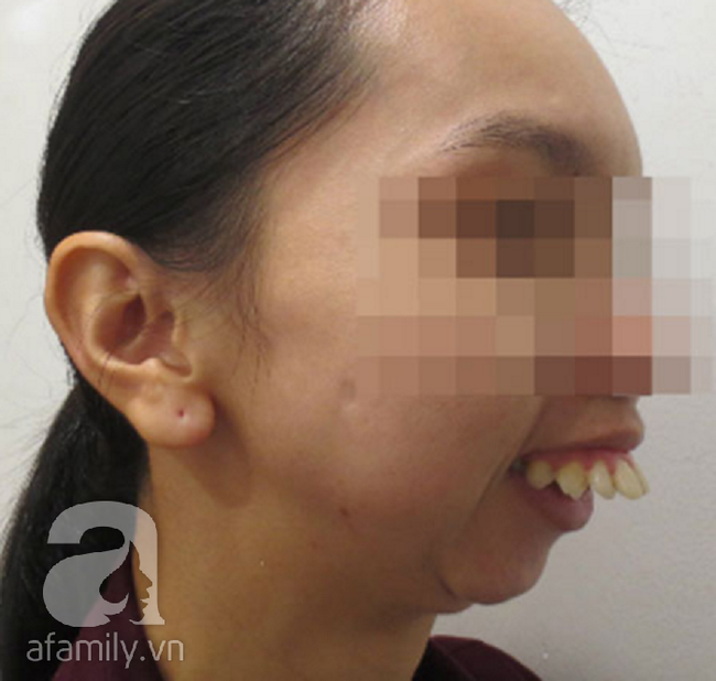 C&ocirc; g&aacute;i &ldquo;răng chuột&rdquo; qua 45 lần phẫu thuật, 30 năm kh&ocirc;ng thể ngủ nằm được cứu vớt cuộc đời - Ảnh 1.