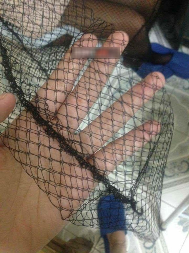 Éo le: Mua áo lưới thời trang qua mạng, cô gái bất ngờ nhận được… tấm lưới đánh cá - Ảnh 2.