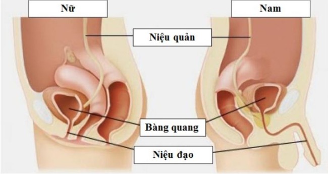 Tự khều sỏi thận, người đàn ông bị vướng cỏ trong… “chỗ hiểm” - Ảnh 2.