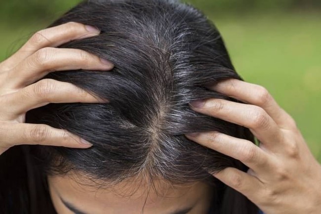 Đừng xem nhẹ, tóc bạc sớm cũng là dấu hiệu cảnh báo hàng loạt vấn đề sức khỏe - Ảnh 2.