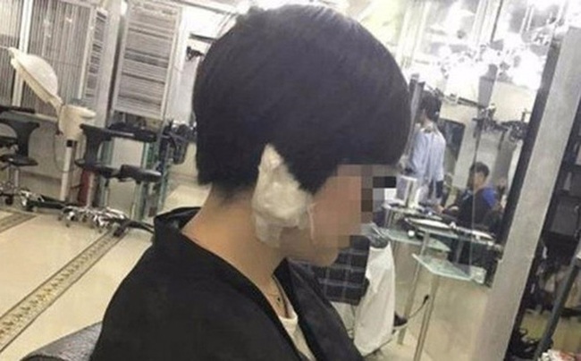  Trung Quốc: Đến tiệm làm đẹp, người phụ nữ trẻ bị thợ cắt tóc xẻo mất dái tai - Ảnh 1.