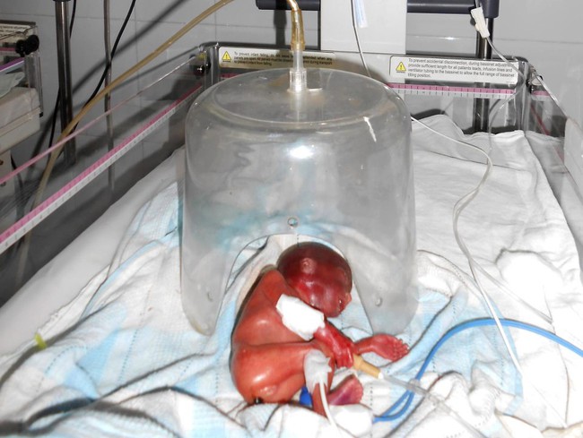 Em bé sinh non 24 tuần tuổi bất ngờ sống dậy vài giây trước khi gia đình hỏa táng - Ảnh 3.