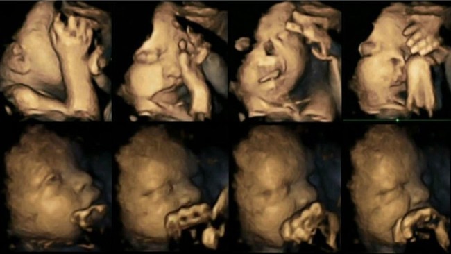 Đau lòng hình ảnh thai nhi vật vã, đau đớn khi người mẹ mang thai hút thuốc - Ảnh 1.