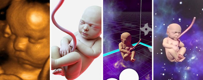 Công nghệ mới nhất giúp bố mẹ nhìn thấy thai nhi rõ như thật, hơn hẳn siêu âm - Ảnh 2.