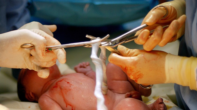 Đây là lý do các mẹ nên yêu cầu bác sĩ trì hoãn cắt dây rốn cho con sau sinh - Ảnh 4.