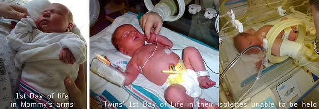 Nếu bạn tò mò mang thai đơn và song thai khác nhau thế nào, hãy xem những hình ảnh này - Ảnh 8.
