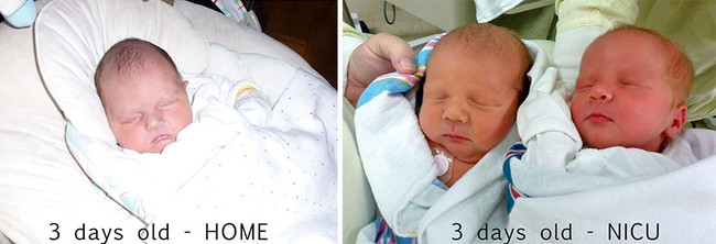Nếu bạn tò mò mang thai đơn và song thai khác nhau thế nào, hãy xem những hình ảnh này - Ảnh 9.