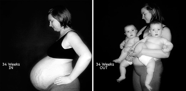 Nếu bạn tò mò mang thai đơn và song thai khác nhau thế nào, hãy xem những hình ảnh này - Ảnh 10.
