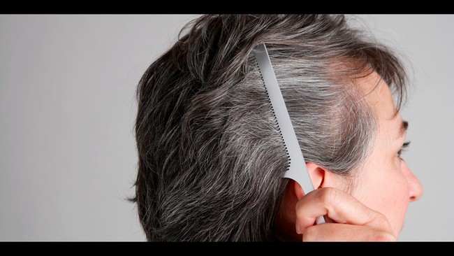 Đừng xem nhẹ, tóc bạc sớm cũng là dấu hiệu cảnh báo hàng loạt vấn đề sức khỏe - Ảnh 3.