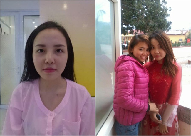 Bị bạn trai bỏ vì người thứ 3 xinh đẹp, cô gái Quảng Ninh chi tiền khủng đi thẩm mỹ - Ảnh 2.