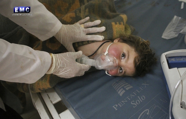 Rớt nước mắt khi nghe nữ bác sĩ kể về em bé Syria bị đốt cháy như vỏ cây xơ xác - Ảnh 3.
