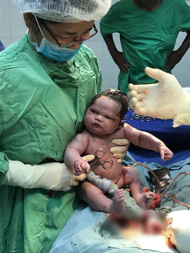 Bức ảnh gây bão mạng: Em bé sơ sinh đang ngủ ngon thì bị bác sĩ đưa ra khỏi bụng mẹ trong ca sinh mổ - Ảnh 2. Bức ảnh gây bão mạng: Em bé sơ sinh đang ngủ ngon thì bị bác sĩ đưa ra khỏi bụng mẹ trong ca sinh mổ - Ảnh 2.