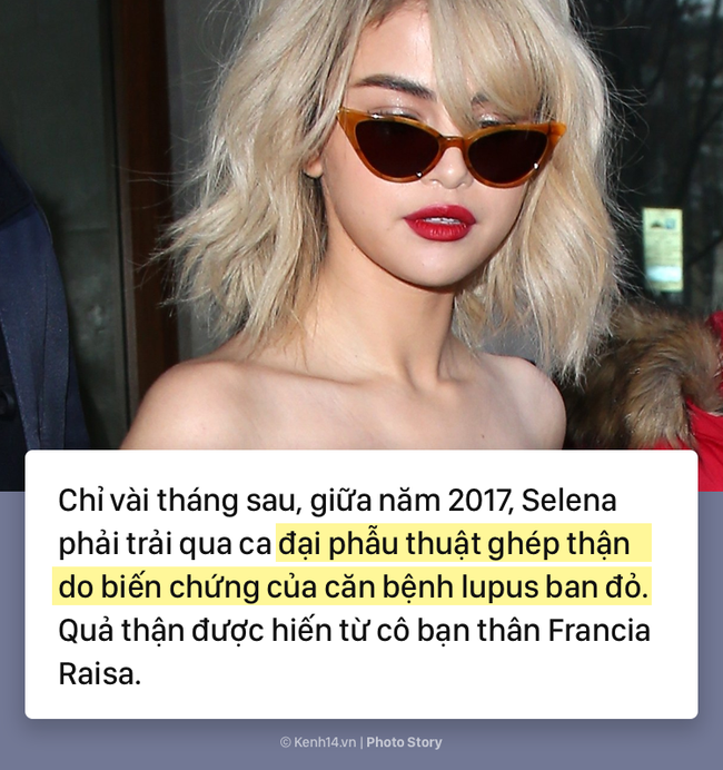 Selena Gomez và hành trình 5 năm chống chọi với căn bệnh lupus ban đỏ kèm di chứng - Ảnh 6.