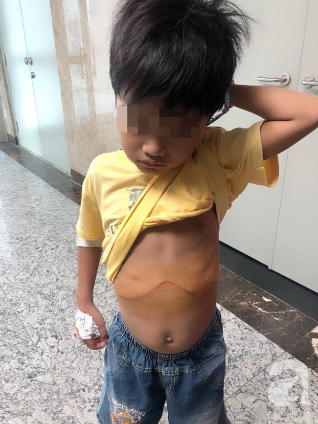 Bé trai 7 tuổi nôn ra đầy bát máu vì căn bệnh vô cùng hiểm ác - Ảnh 1.