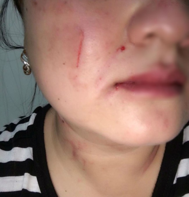 Vợ trẻ đăng đàn tố chồng đánh mình giữa đêm và màn phản pháo, nhưng dân mạng chỉ quan tâm điều này - Ảnh 2. Vợ trẻ đăng đàn tố chồng đánh mình giữa đêm và màn phản pháo, nhưng dân mạng chỉ quan tâm điều này - Ảnh 2.