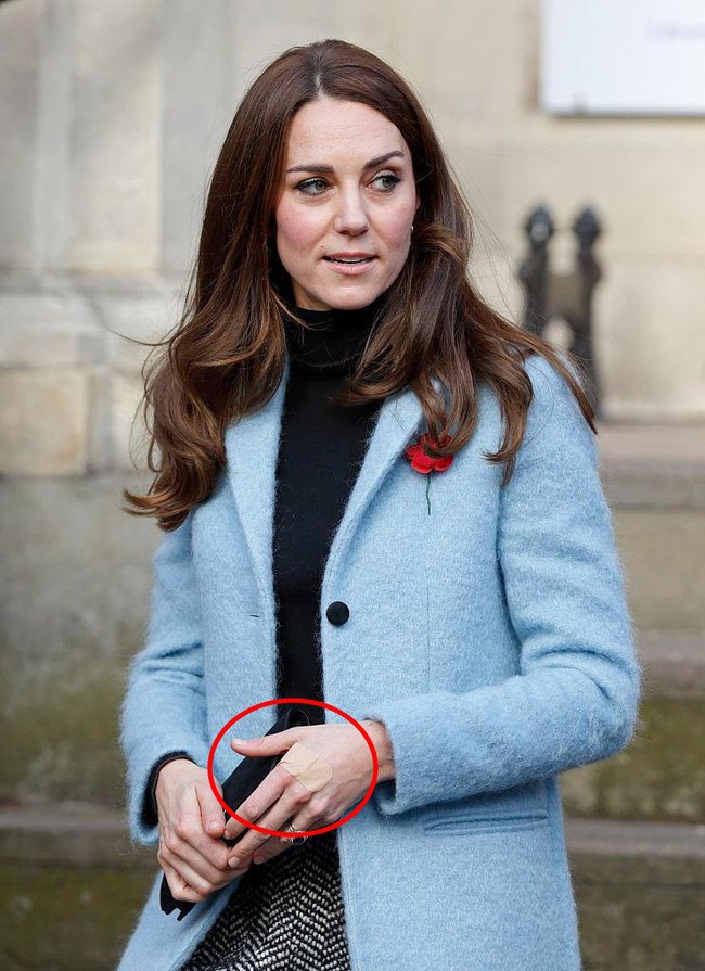 Công nương Kate là nàng dâu “hậu đậu nhất” hoàng gia bởi một loạt vết tích trên tay không giống ai của mình - Ảnh 4.