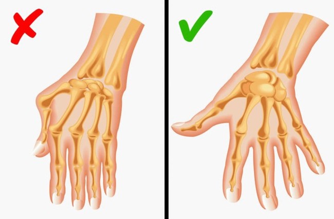 10 căn bệnh có nguy cơ lây truyền từ mẹ sang con gái - Ảnh 2. 10 căn bệnh có nguy cơ lây truyền từ mẹ sang con gái - Ảnh 2.
