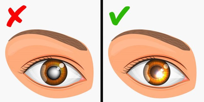 10 căn bệnh có nguy cơ lây truyền từ mẹ sang con gái - Ảnh 5. 10 căn bệnh có nguy cơ lây truyền từ mẹ sang con gái - Ảnh 5.